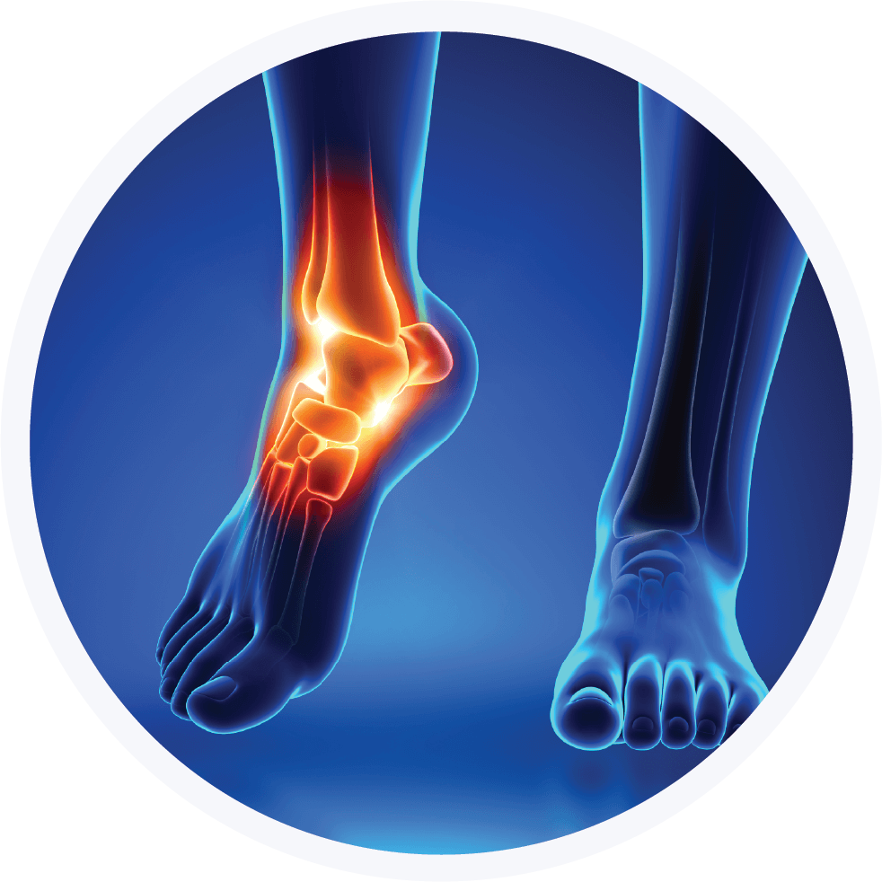 Foot and Ankle Pain