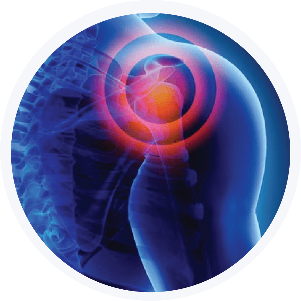 Shoulder Injuries