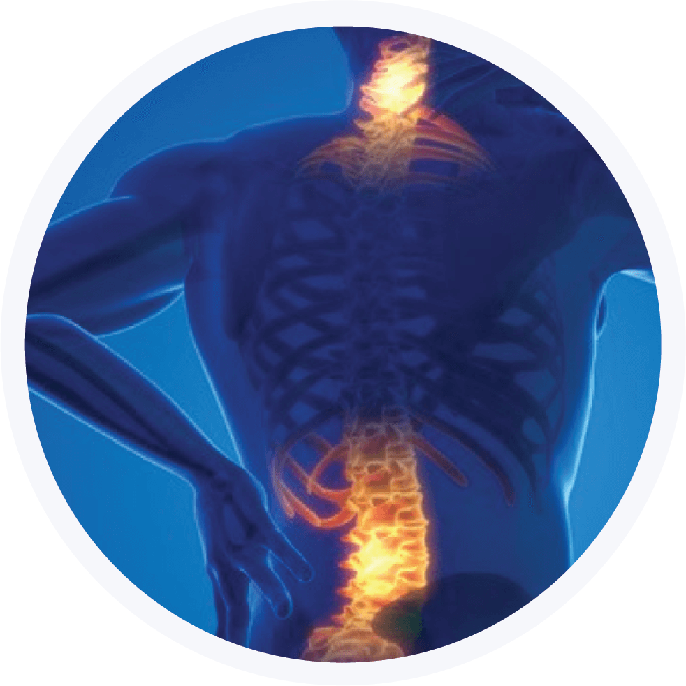 Neck and Back Pain